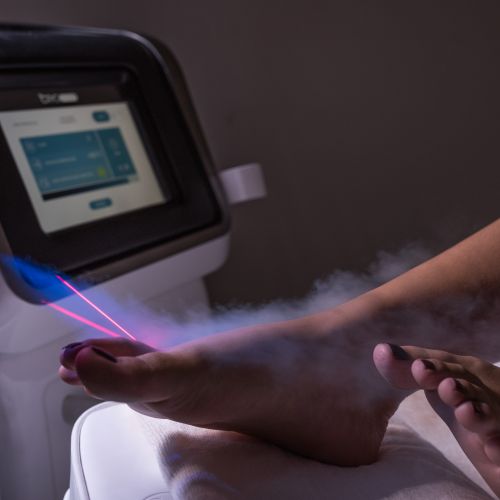 Penguin Female - Localised CRYO - Ankle 3 Penguin Female - Localised CRYO - Ankle 3